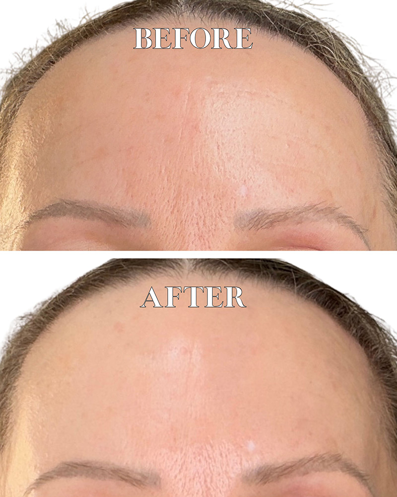best growth factor serum before after dr diamond