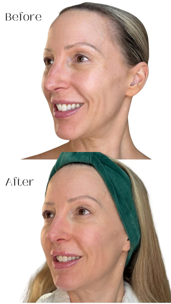 eighth day skin review does it work results