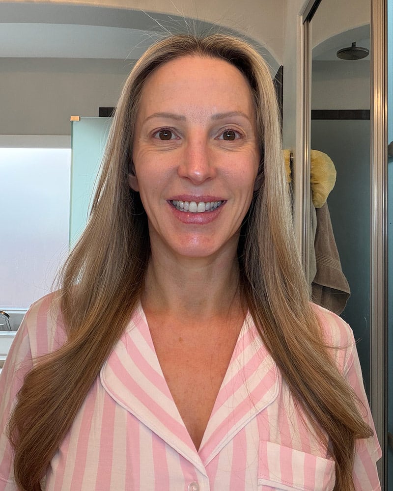 Dr Brandt Wrinkle Release Serum before 