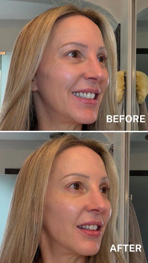 Dr Brandt skincare Wrinkle Release Serum before after results