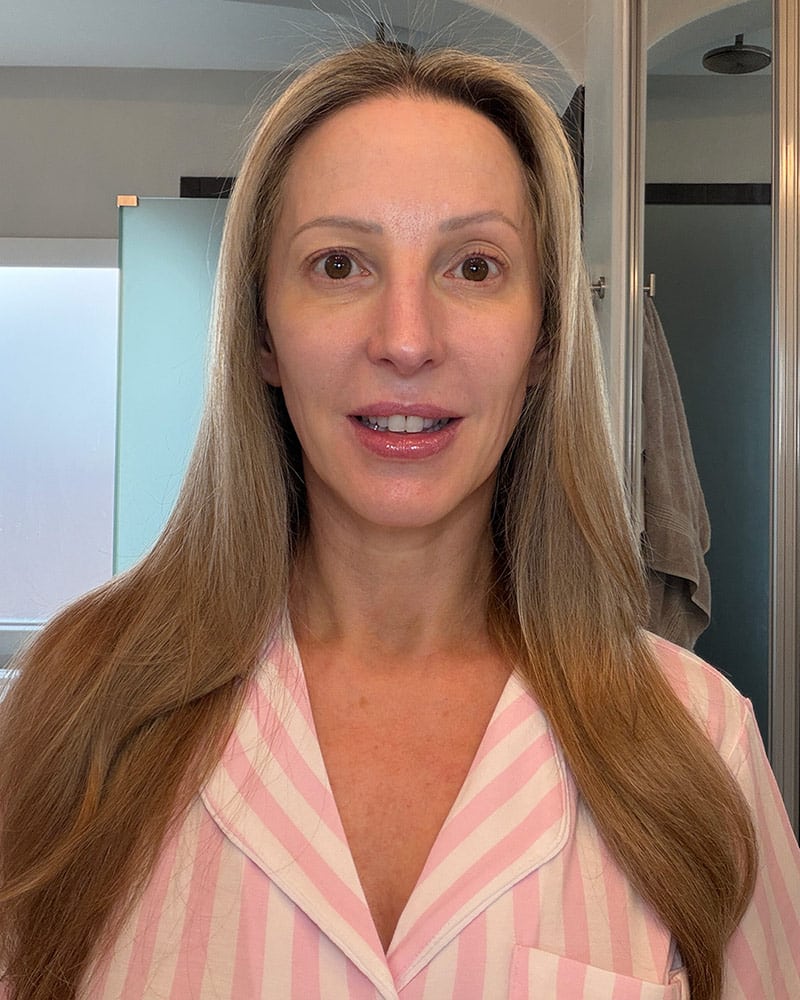 Dr Brandt Wrinkle Release Serum before after