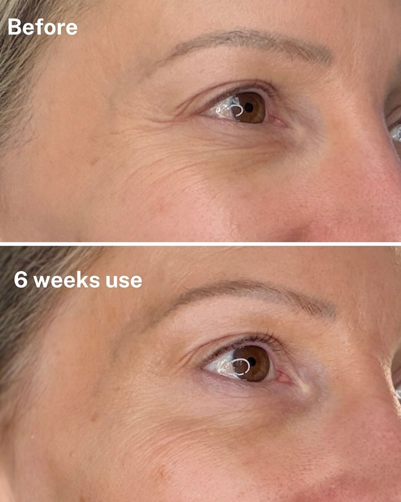 best eye cream crowns feet Dr Diamond's Eyelift contour collection