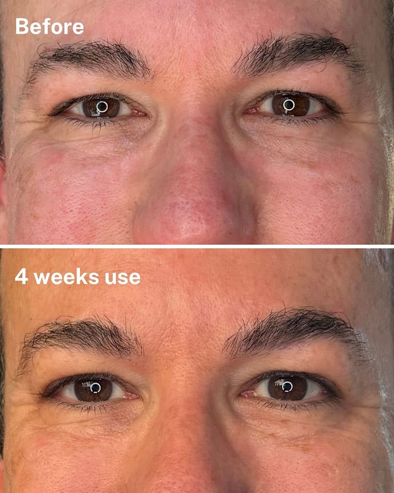 best eye cream men anti aging